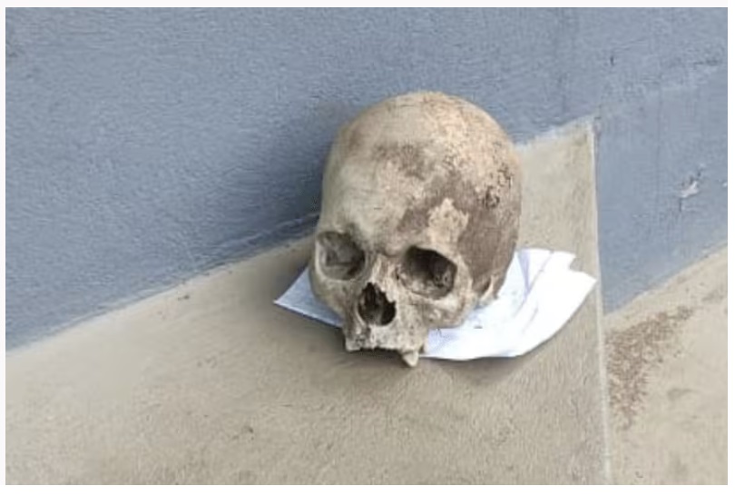 Polícia Civil divulga imagem de crânio deixado em delegacia —