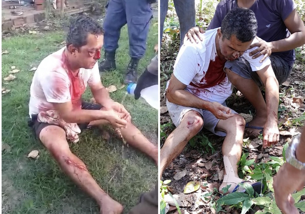 Na primeira imagem, Edson Rui Cordeiro Marques ficou ferido no primeiro acidente [no dia 27 de abril]; e na segunda foto, o mesmo piloto agora, no dia 27 de julho, também ficou ferido na segunda queda de avião.